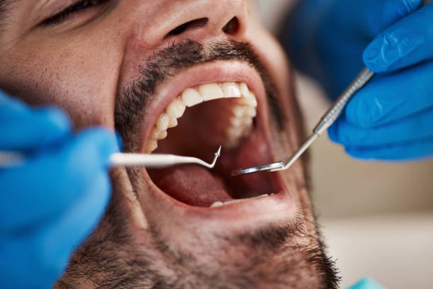 Best Emergency Dental Care for Broken or Chipped Teeth in Beavercreek, OR